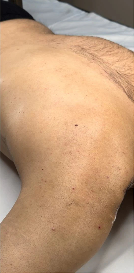After using product